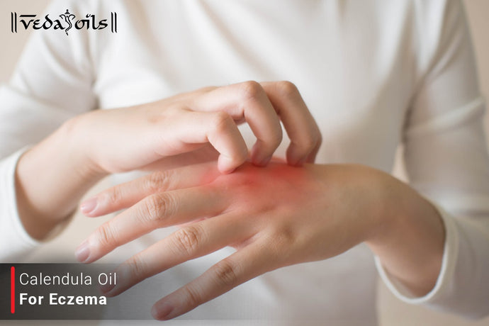 Calendula Oil For Eczema - Ways To Use It