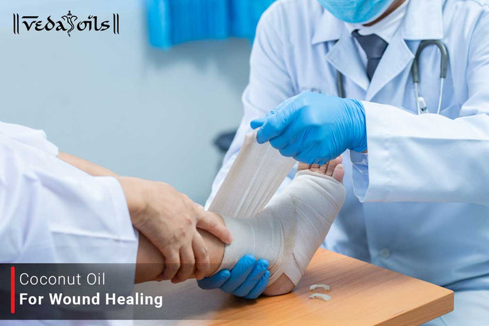 Coconut Oil For Wound Healing - How To Use Guide?