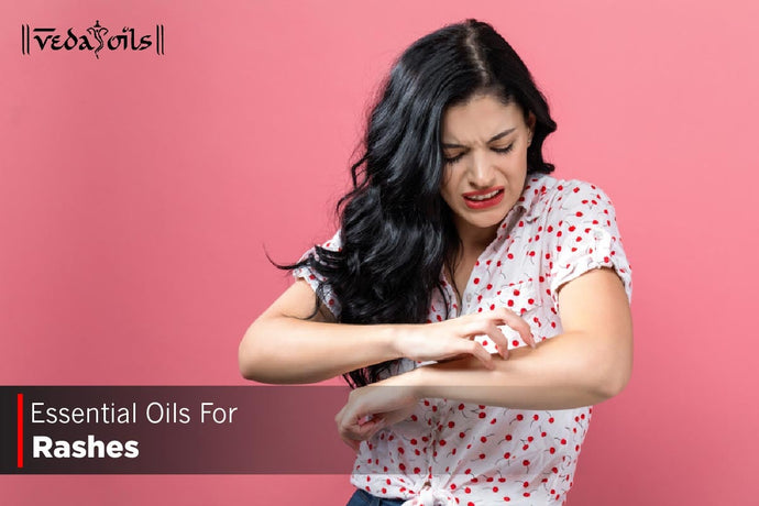 Essential Oils For Rashes - Natural Oils For Skin Irritation