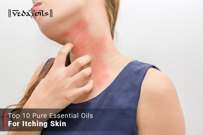 Essential Oils For Itching | Best Antifungal Itch Oil for Skin Rash