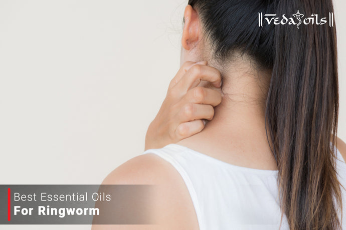 Essential Oils for Ringworm | Best Natural Oils for Ringworms
