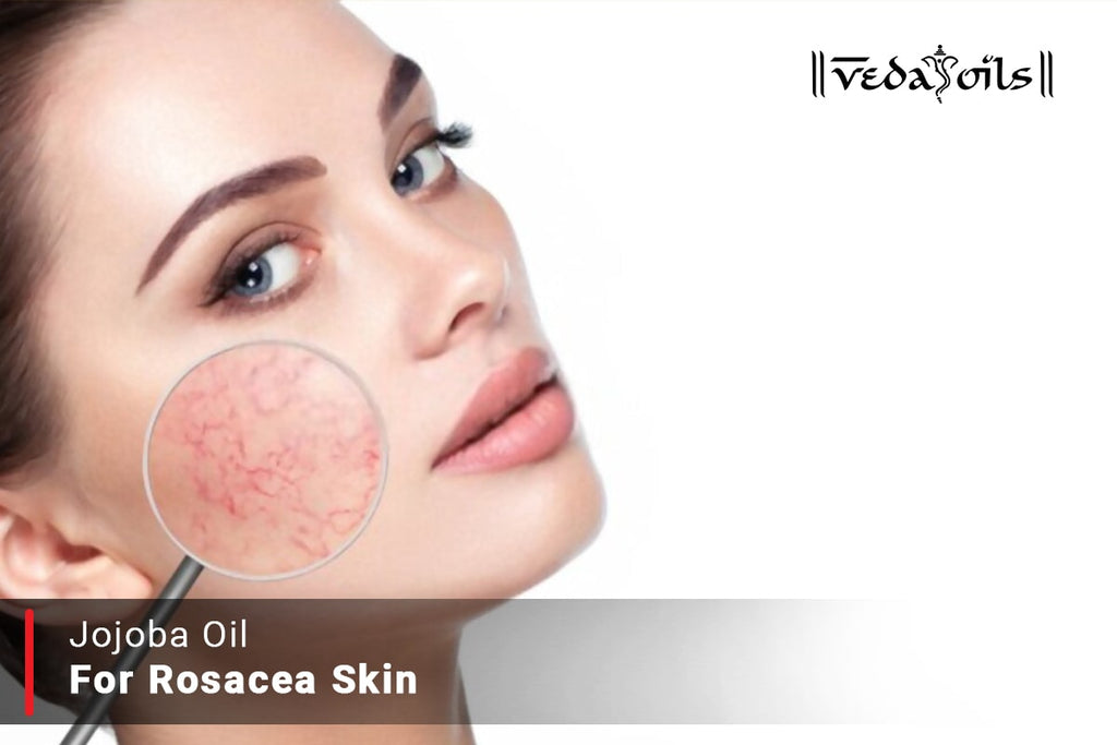 Jojoba Oil For Rosacea How To Use It? VedaOils