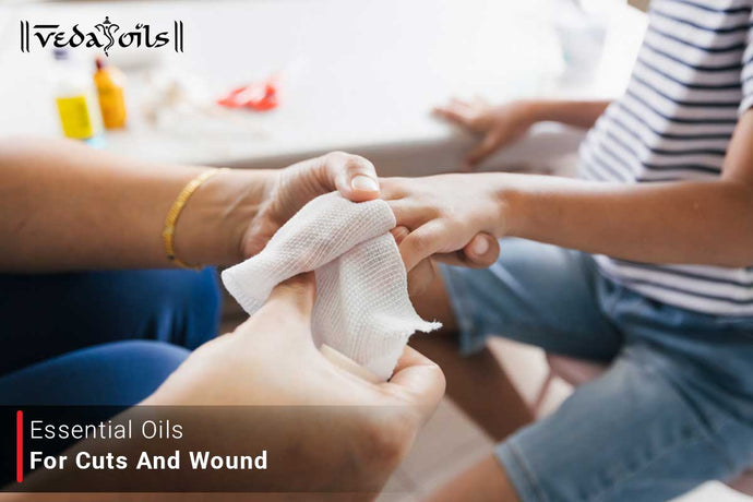 Essential Oils For Cuts and Wounds | Antiseptic Oils For Scrapes