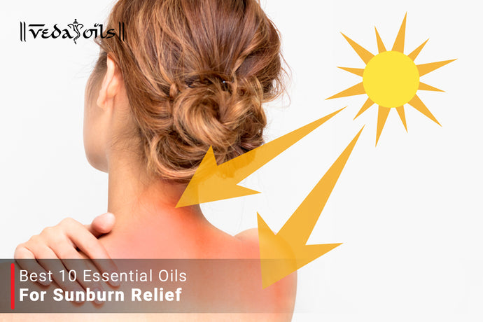 Essential Oils For Sunburn - Natural Redness Relief Oils