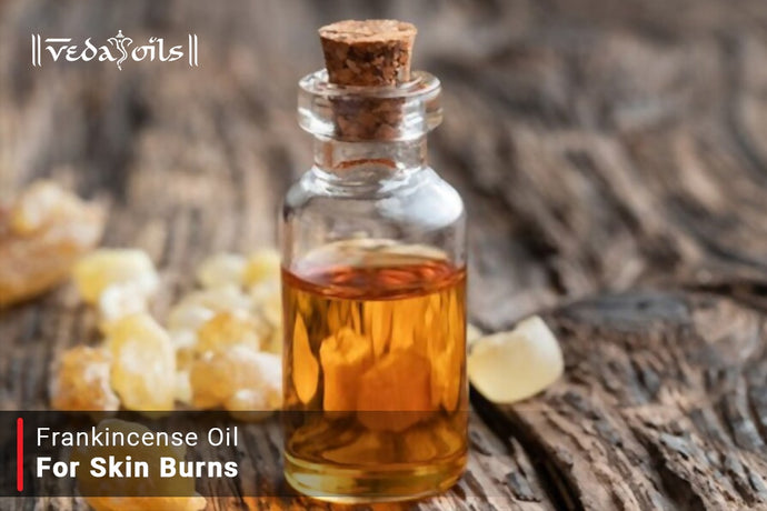Frankincense Oil For Burns, Skin Irritations, and Other Wounds