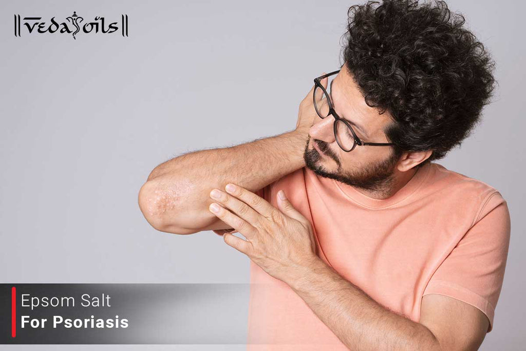 Epsom Salt For Psoriasis Benefits & Recipes VedaOils