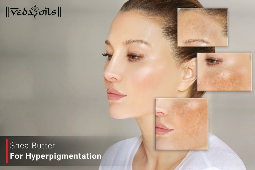 Shea Butter For Pigmentation Do Shea Butter Fade Dark Spots? VedaOils