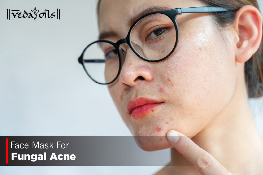 Homemade Face Mask For Fungal Acne - 5 Easy DIY Recipes