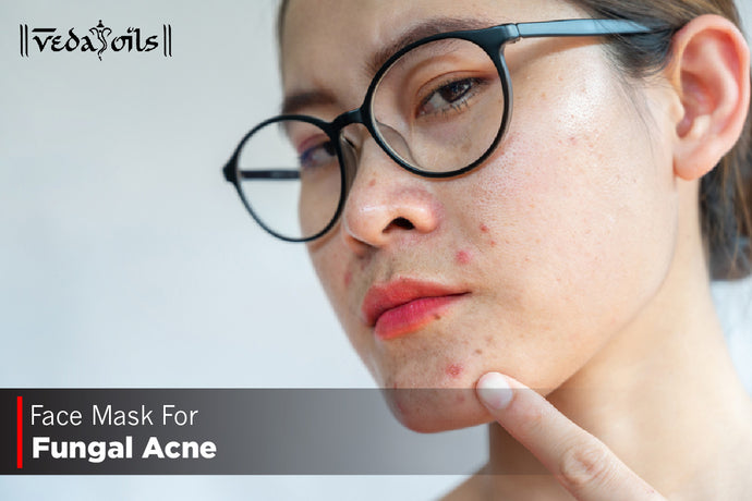 Face Mask For Fungal Acne -  5 Easy DIY Recipes