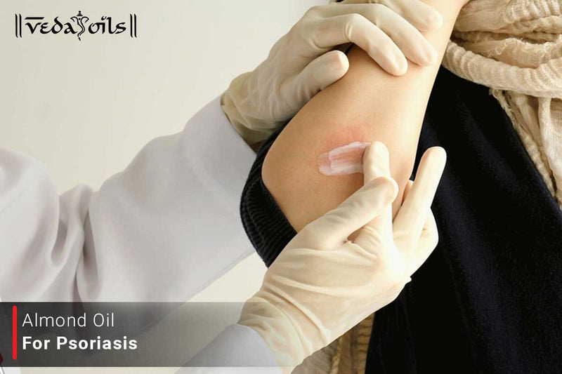 Almond Oil For Psoriasis - Benefits & How To Use