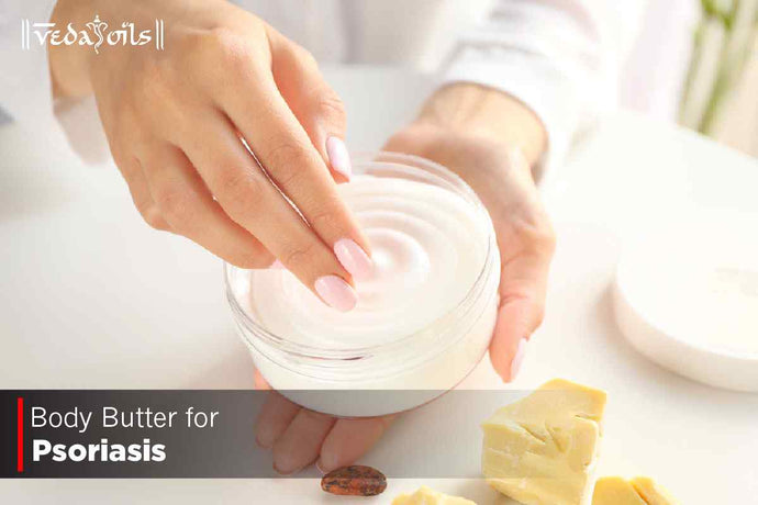 Body Butters For Psoriasis - DIY Recipe