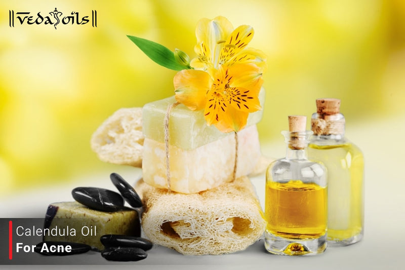 Calendula Oil For Acne Scars - Uses & Benefits