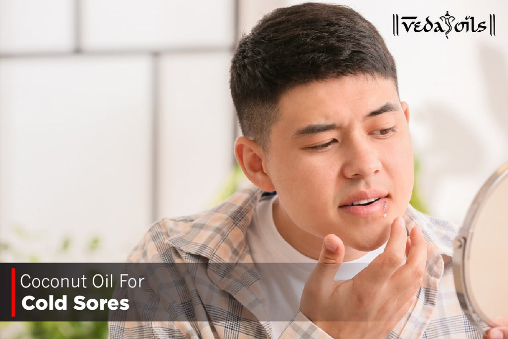 Coconut Oil For Cold Sores Benefits & How To Use VedaOils