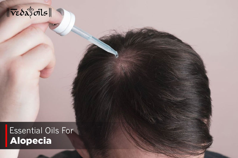 Best 10 Essential Oils For Alopecia - Hair Loss Treatment