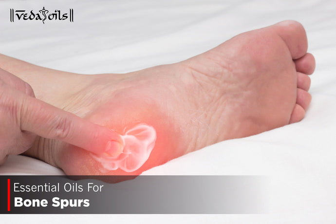 Essential Oils For Bone Spurs - Heel Spur Treatment