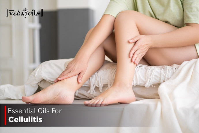 Essential Oils For Cellulitis - Home Treatment