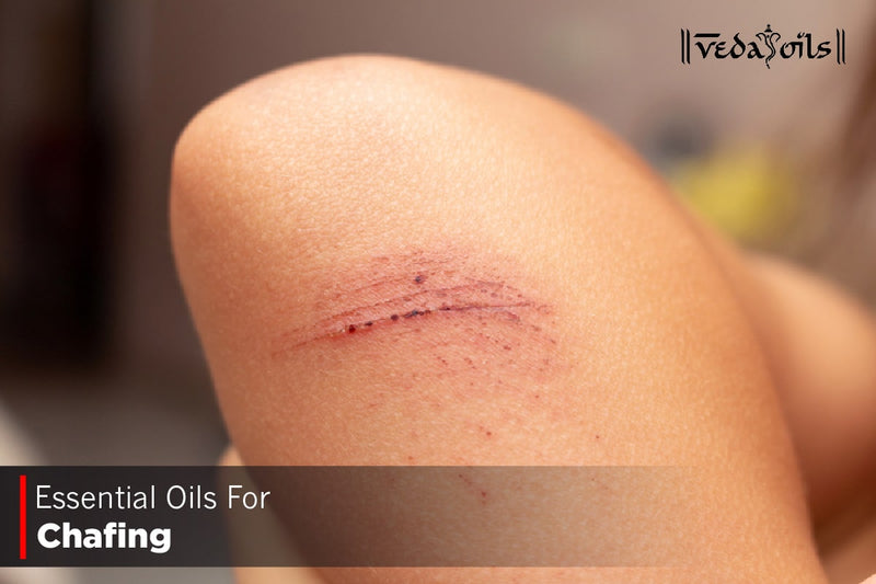 Essential Oils For Chafing