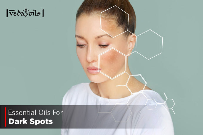 Essential Oils For Dark Spots - To Remove Dark Spots