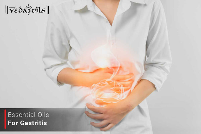 Essential Oils For Gastritis - Natural Treatments at Home
