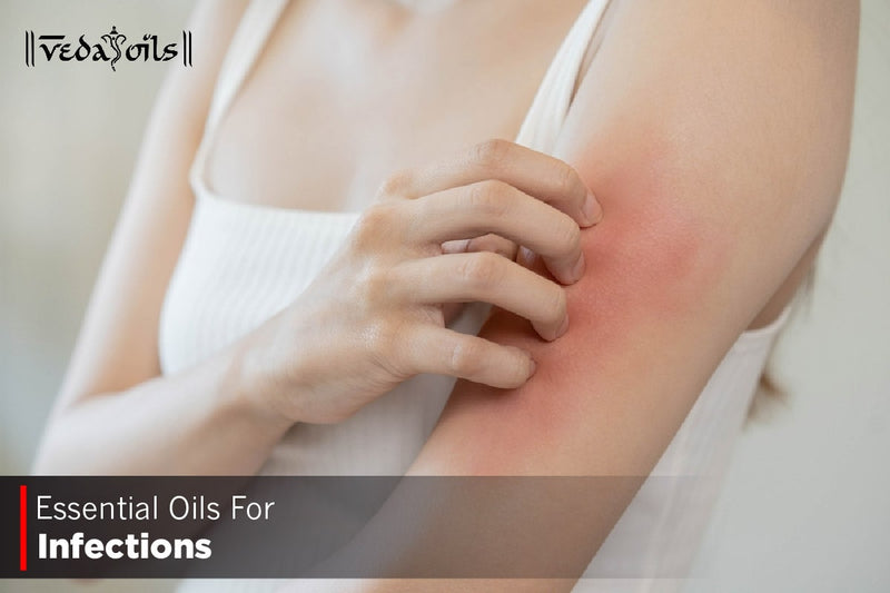 10 Essential Oils for Infections: Fight Bacteria & Viruses Naturally
