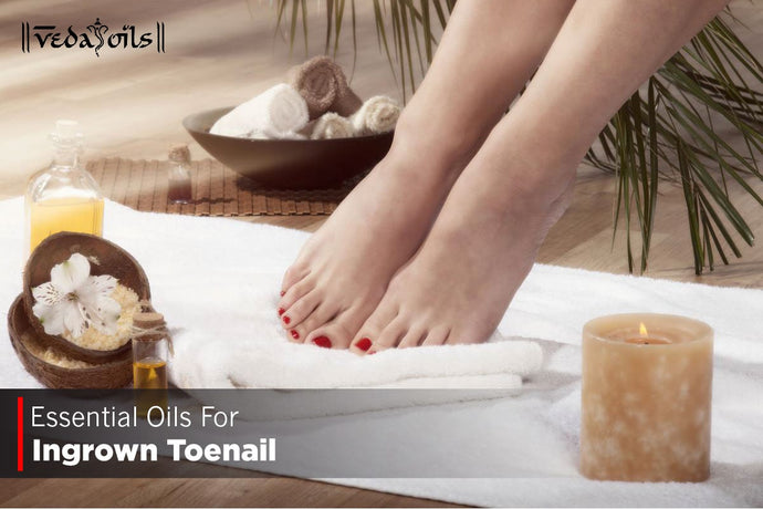 Essential Oils For Ingrown Toenail - Ingrown Fingernail Removal