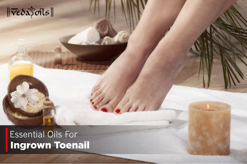 Top 10 Essential Oils For Ingrown Toenail