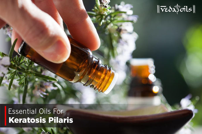 Essential Oils For Keratosis Pilaris - Treating KP With Oils
