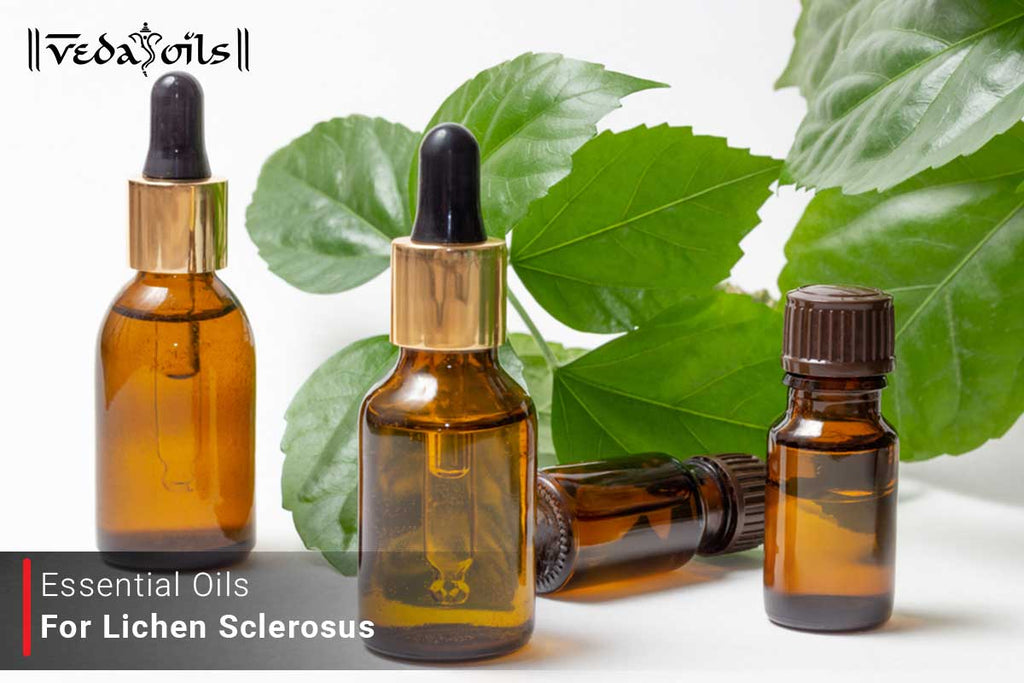10 Best Essential Oils For Lichen Sclerosus VedaOils