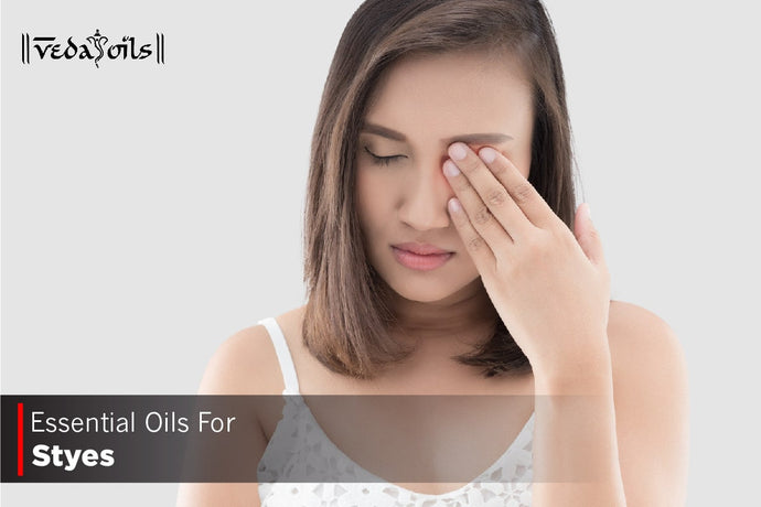 Essential Oils For Styes - Natural Remedies