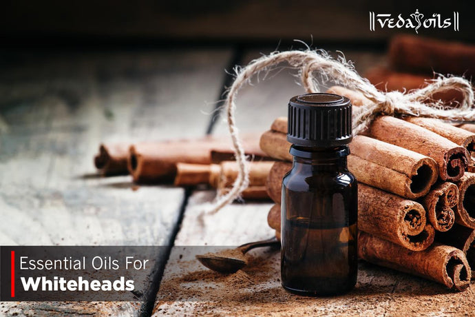 Essential Oils For Whiteheads - Face Oils For Whiteheads