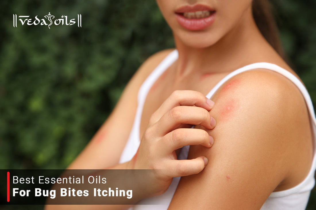 Essential Oils For Bug Bites