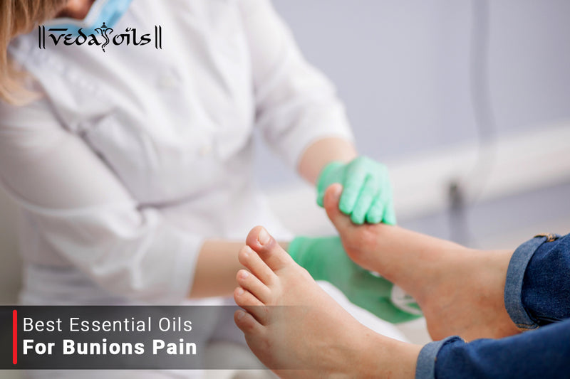 Essential Oils For Dissolving Bunions Pain