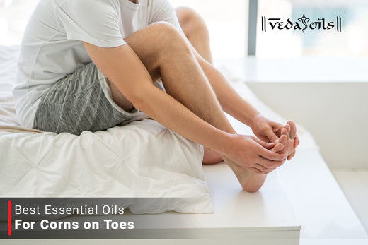Essential Oils for Corns