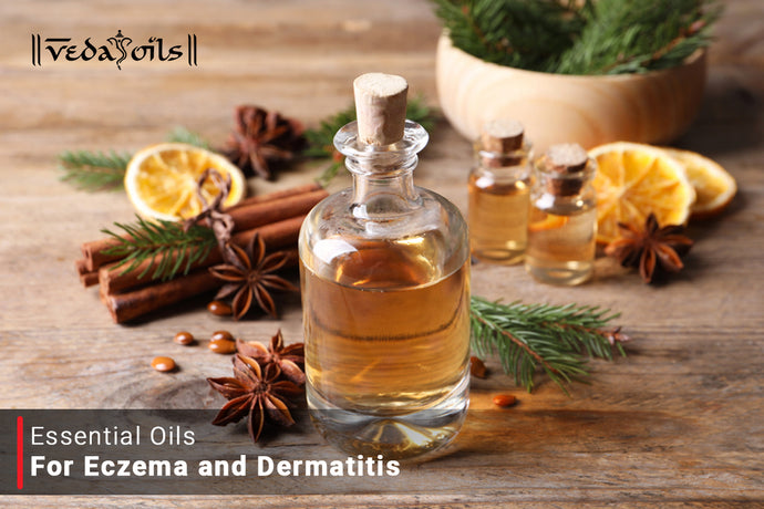 Essential Oils For Eczema - Natural Treatment