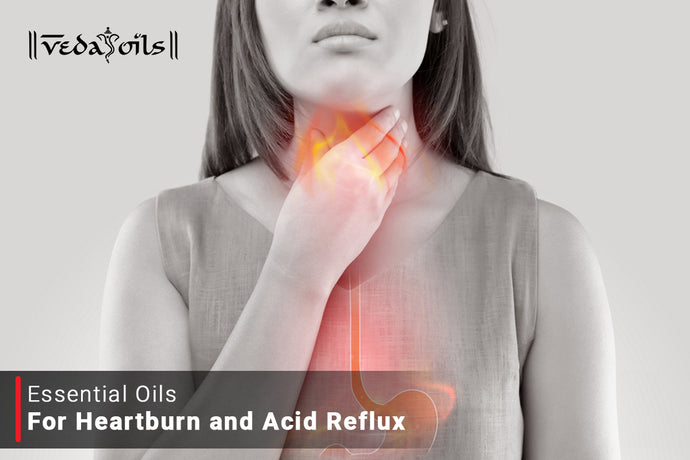 Essential Oils for Heartburn | Best Oils for Acid Reflux & Indigestion Relief