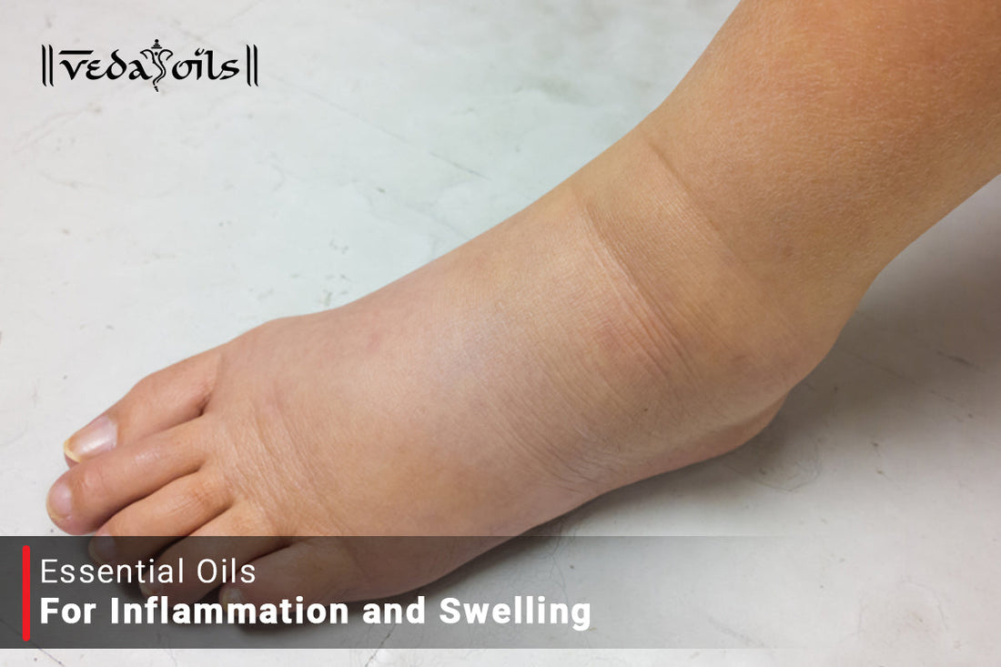 Essential Oils for Inflammation