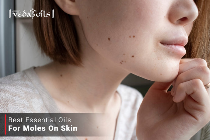 Essential Oils for Mole Removal | Skin Moles Cleansing Natural Oils
