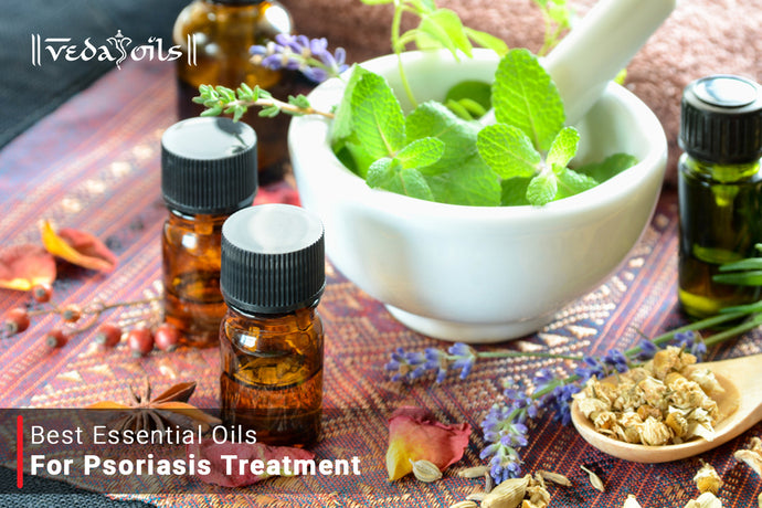 Essential Oils for Psoriasis | Best Natural Oils for Psoriasis Treatment