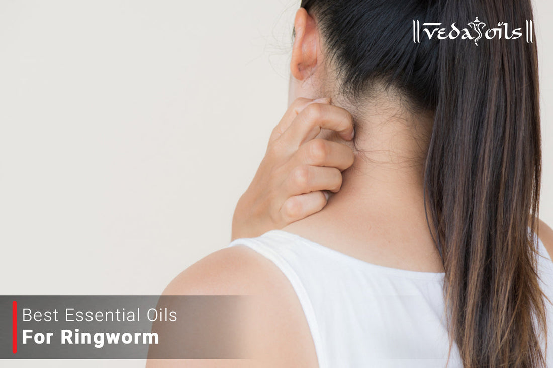 Essential Oils for Ringworm