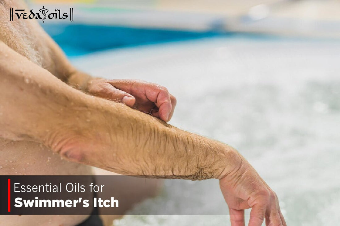 Essential Oils for Swimmer's Itch