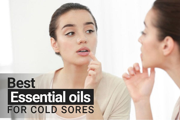 Essential Oils For Cold Sores - How to Use Blends Perfectly