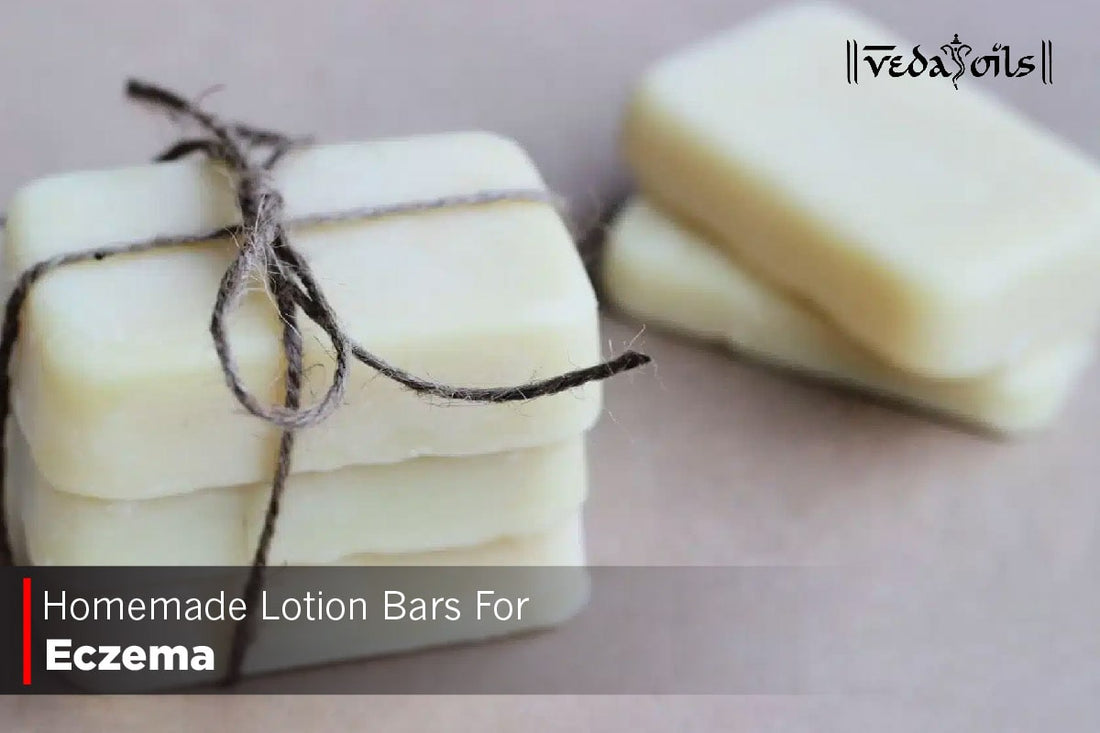 Homemade Lotion Bars For Eczema - Recipes, Tips & Tricks
