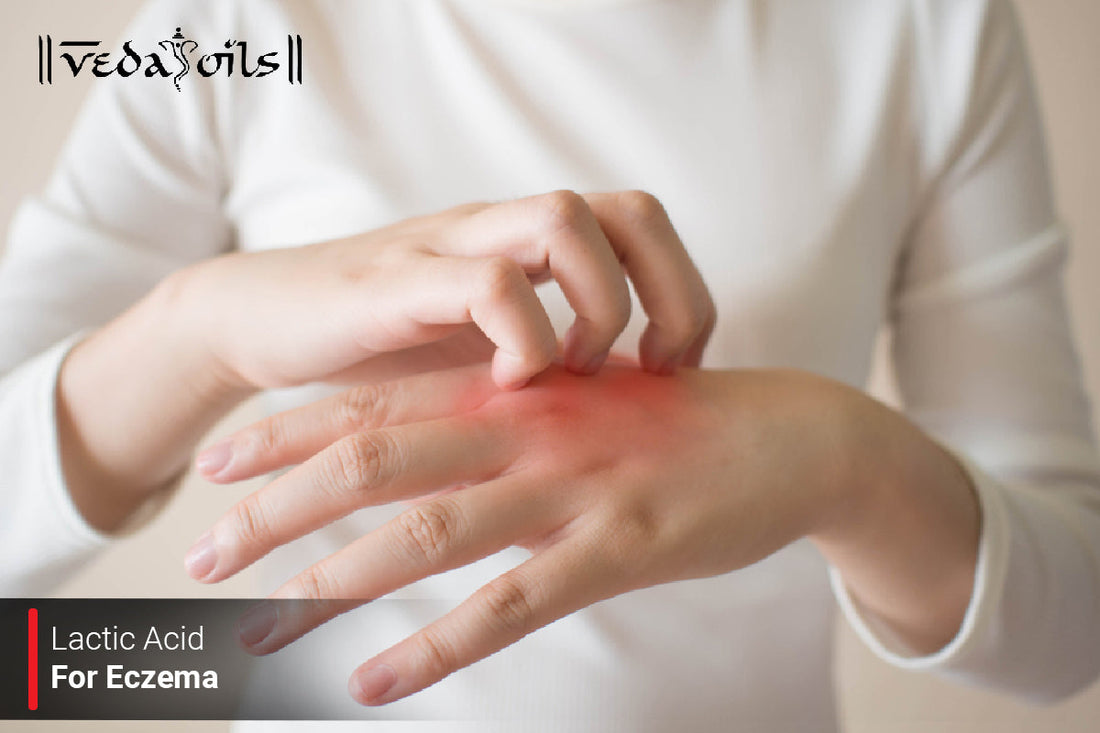 Lactic Acid For Eczema