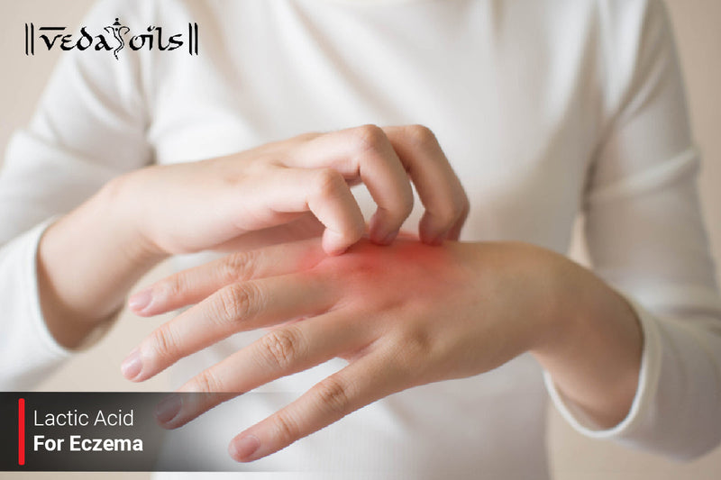 Lactic Acid For Eczema - Is Lactic Acid Good For Eczema?
