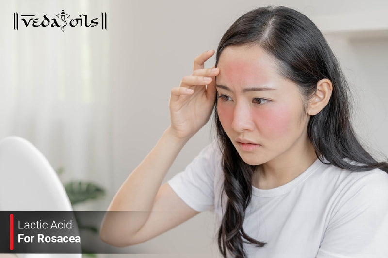 Lactic Acid For Rosacea - Is Lactic Acid Good For Rosacea?