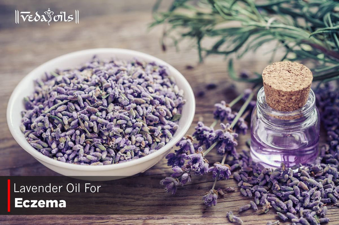Lavender Oil For Eczema