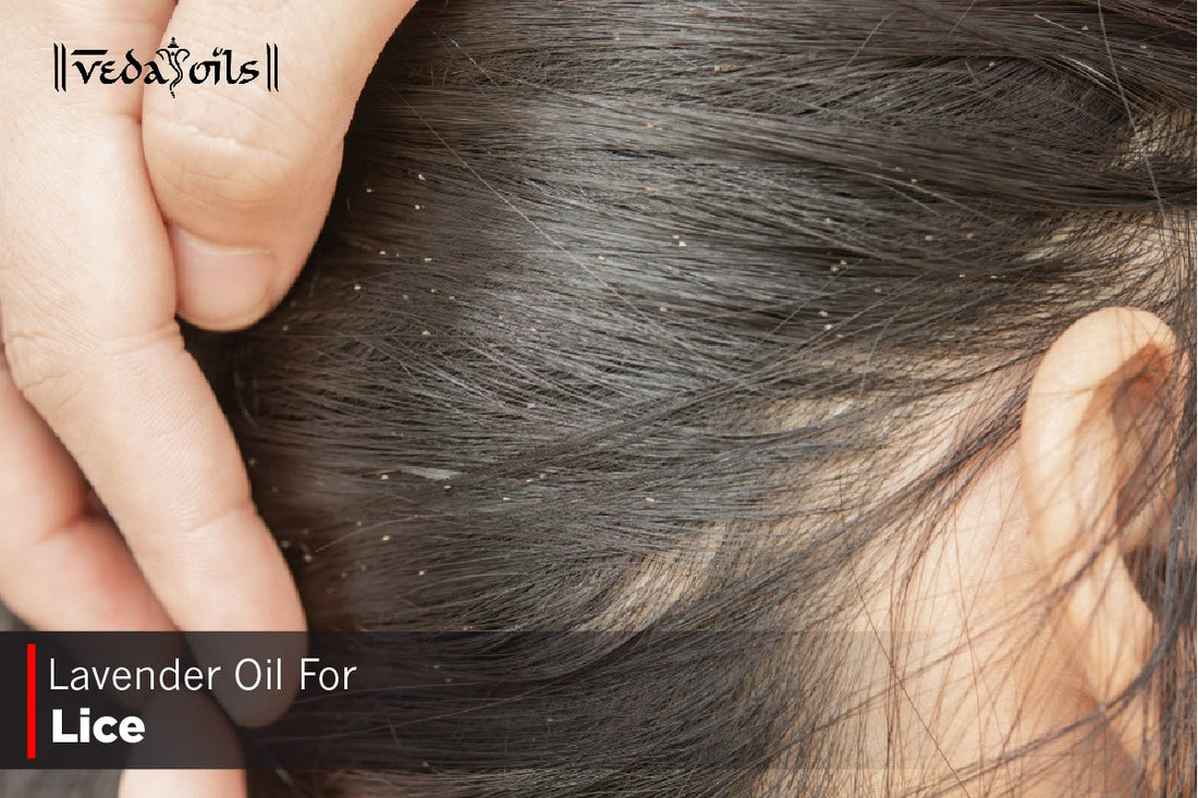 Lavender Oil For Lice