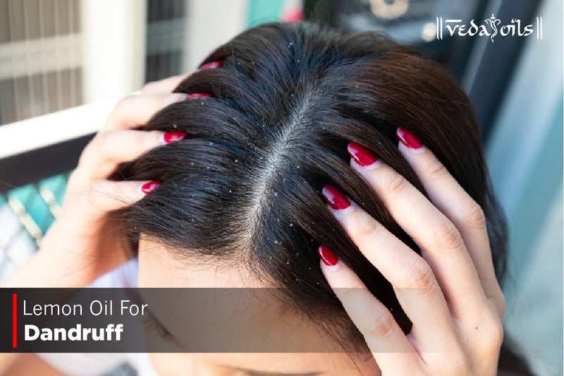 Lemon Oil For Dandruff - Benefits, Recipe & How To Use