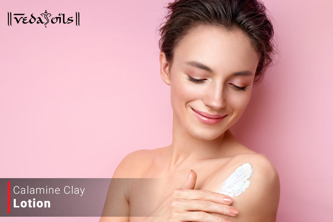 calamine lotion