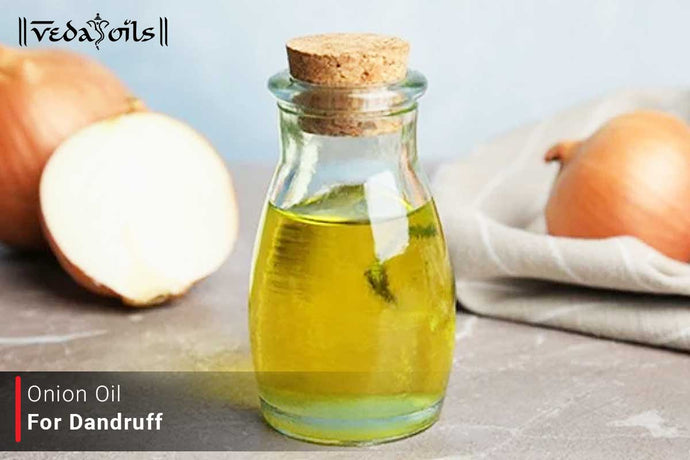 Onion Oil For Dandruff Free Scalp - 3 DIY Recipes To Reduce Flaky Hair